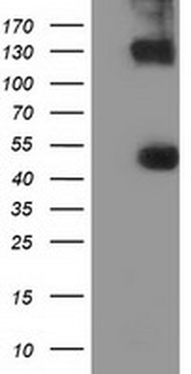 UHMK1 Antibody in Western Blot (WB)