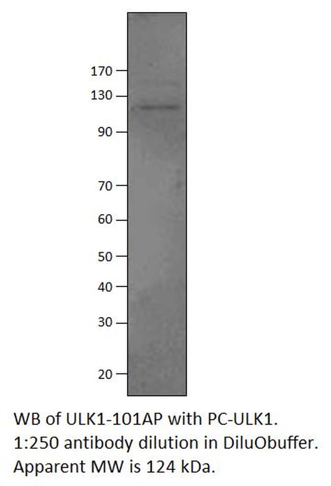 ULK1 Antibody in Western Blot (WB)