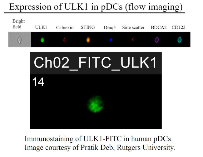 ULK1 Antibody in Immunocytochemistry (ICC/IF)