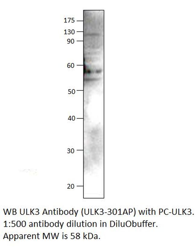 ULK3 Antibody in Western Blot (WB)