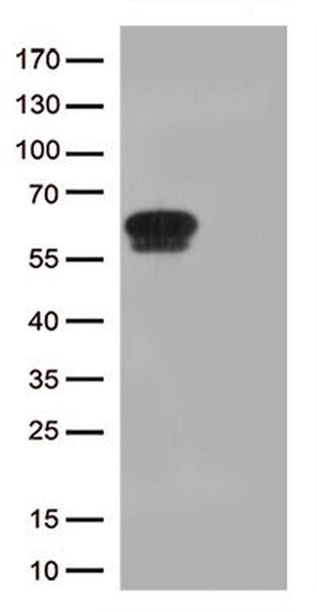 GPA33 Antibody in Western Blot (WB)