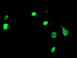 UNG Antibody in Immunocytochemistry (ICC/IF)