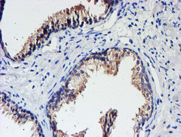 UNG Antibody in Immunohistochemistry (Paraffin) (IHC (P))