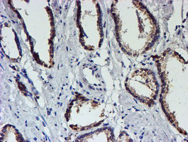 UNG Antibody in Immunohistochemistry (Paraffin) (IHC (P))