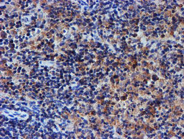 UNG Antibody in Immunohistochemistry (Paraffin) (IHC (P))