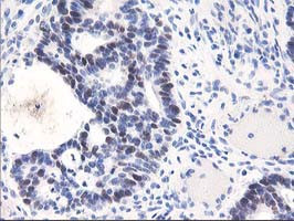 UNG Antibody in Immunohistochemistry (Paraffin) (IHC (P))