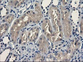 UNG Antibody in Immunohistochemistry (Paraffin) (IHC (P))