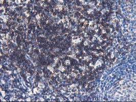 UNG Antibody in Immunohistochemistry (Paraffin) (IHC (P))