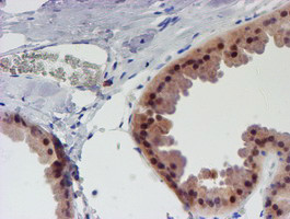 UNG Antibody in Immunohistochemistry (Paraffin) (IHC (P))