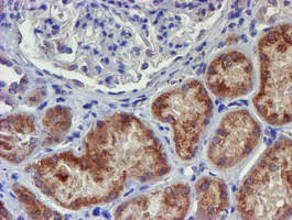 UNG Antibody in Immunohistochemistry (Paraffin) (IHC (P))