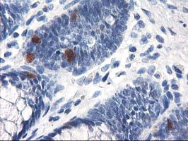 UNG Antibody in Immunohistochemistry (Paraffin) (IHC (P))