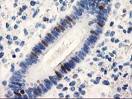 UNG Antibody in Immunohistochemistry (Paraffin) (IHC (P))