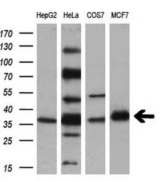 UNG Antibody in Western Blot (WB)