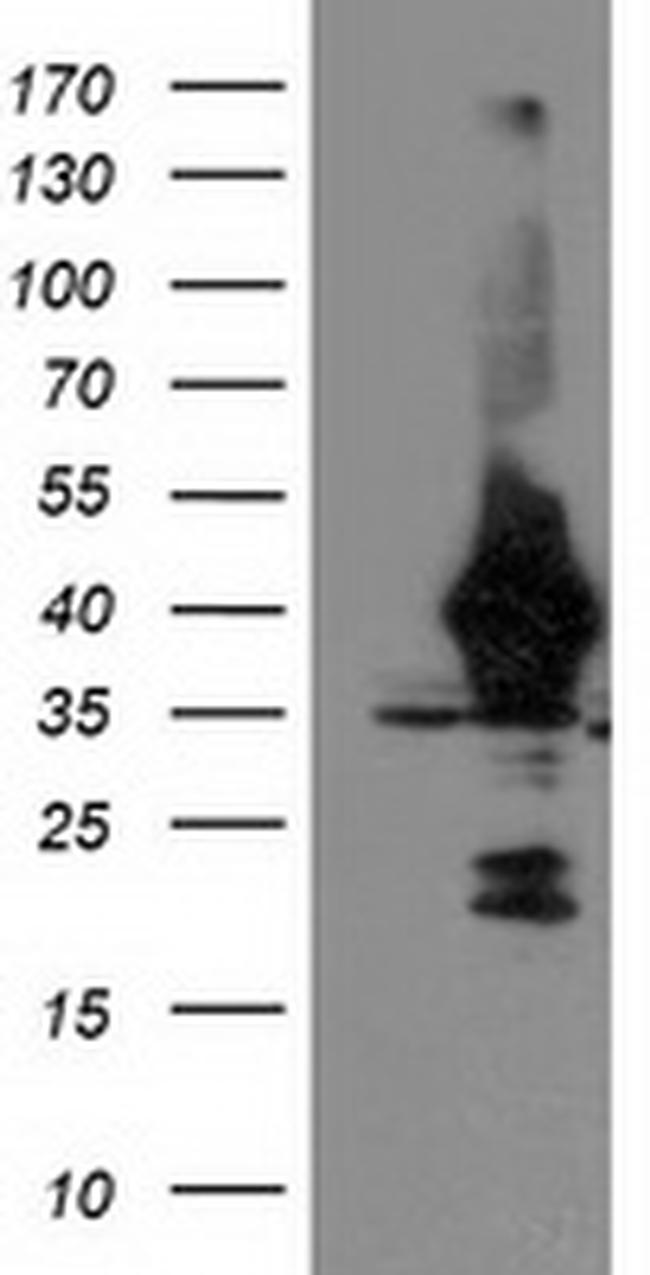 UNG Antibody in Western Blot (WB)