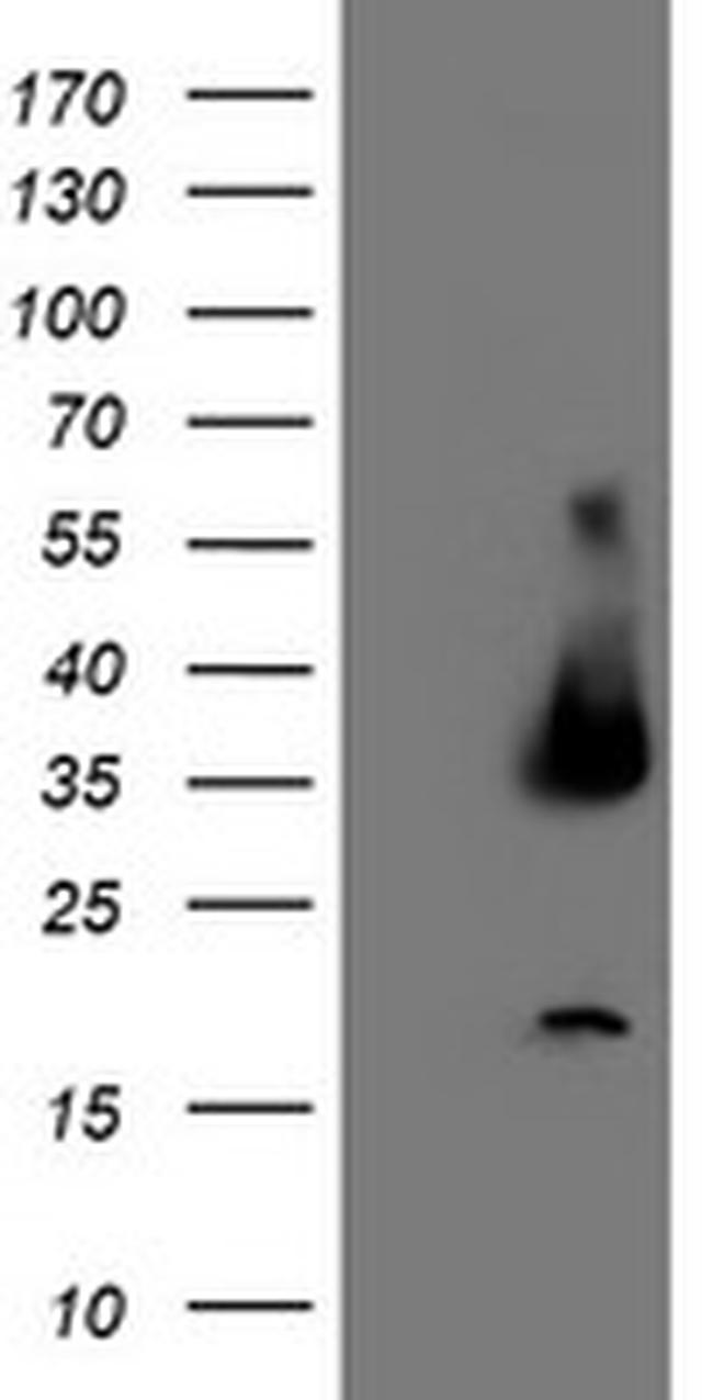 UNG Antibody in Western Blot (WB)