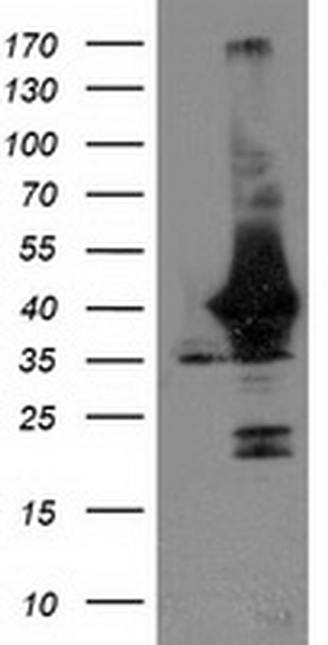 UNG Antibody in Western Blot (WB)