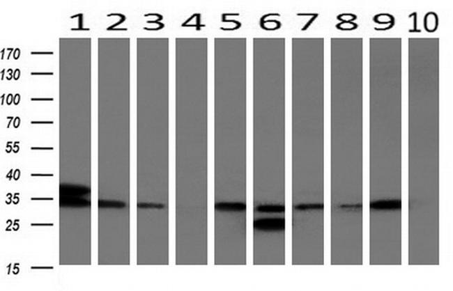 UNG Antibody in Western Blot (WB)