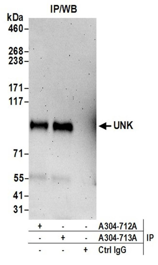 UNK Antibody in Immunoprecipitation (IP)