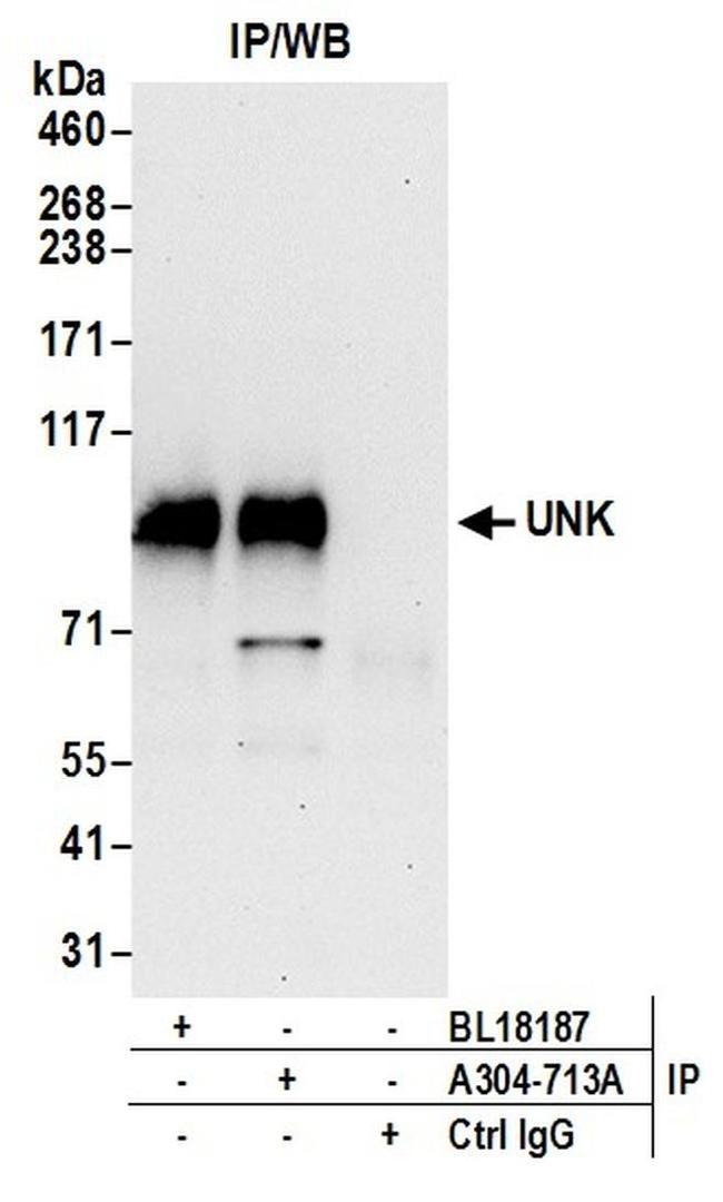 UNK Antibody in Western Blot (WB)