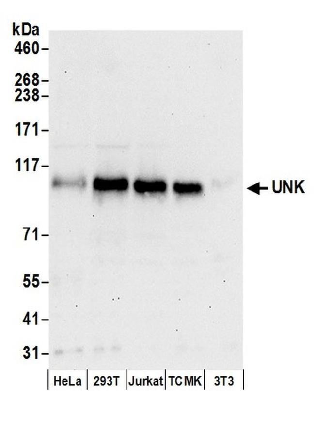 UNK Antibody in Western Blot (WB)