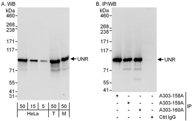 UNR Antibody in Western Blot (WB)