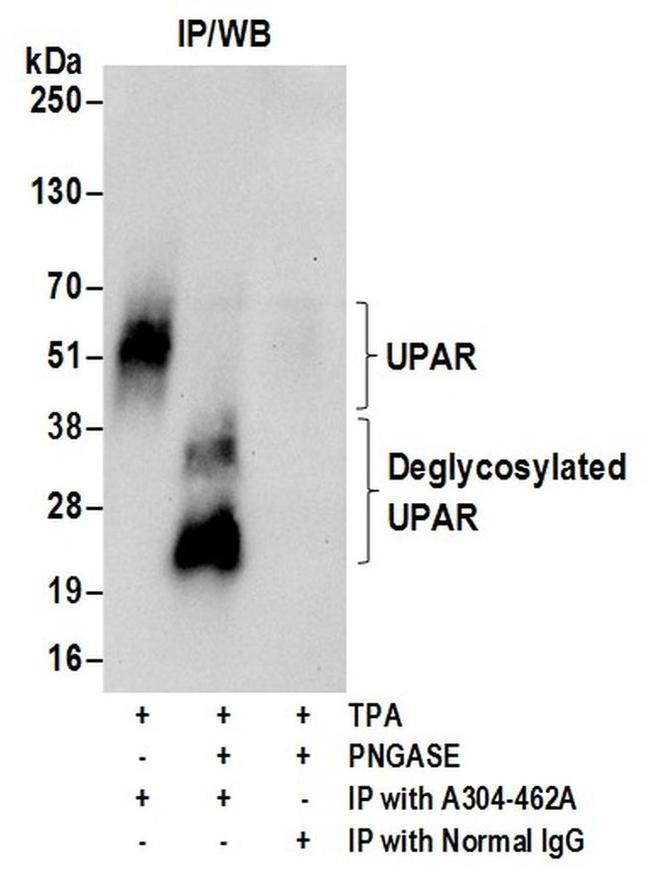 UPAR Antibody in Western Blot (WB)