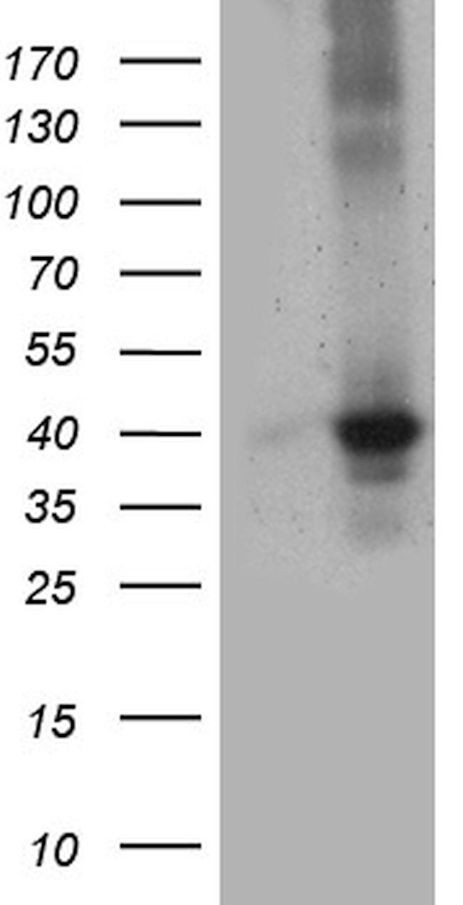 UPP2 Antibody in Western Blot (WB)