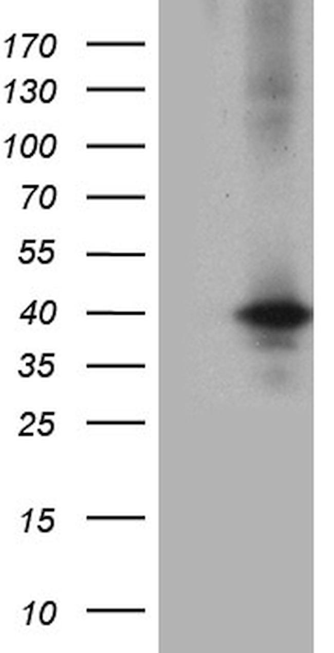 UPP2 Antibody in Western Blot (WB)