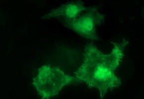 UPRT Antibody in Immunocytochemistry (ICC/IF)