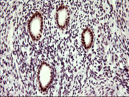 UPRT Antibody in Immunohistochemistry (Paraffin) (IHC (P))