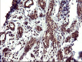 UPRT Antibody in Immunohistochemistry (Paraffin) (IHC (P))