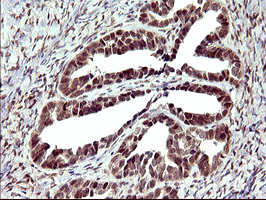 UPRT Antibody in Immunohistochemistry (Paraffin) (IHC (P))