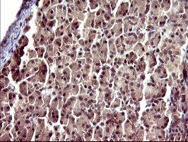 UPRT Antibody in Immunohistochemistry (Paraffin) (IHC (P))