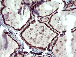 UPRT Antibody in Immunohistochemistry (Paraffin) (IHC (P))