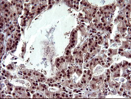 UPRT Antibody in Immunohistochemistry (Paraffin) (IHC (P))