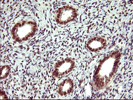 UPRT Antibody in Immunohistochemistry (Paraffin) (IHC (P))