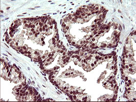 UPRT Antibody in Immunohistochemistry (Paraffin) (IHC (P))