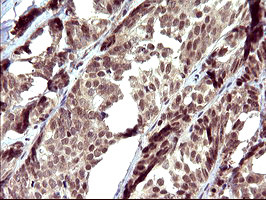 UPRT Antibody in Immunohistochemistry (Paraffin) (IHC (P))