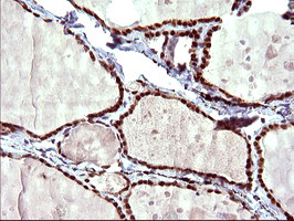 UPRT Antibody in Immunohistochemistry (Paraffin) (IHC (P))