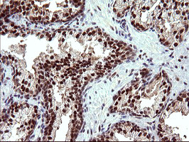 UPRT Antibody in Immunohistochemistry (Paraffin) (IHC (P))