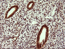 UPRT Antibody in Immunohistochemistry (Paraffin) (IHC (P))