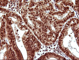 UPRT Antibody in Immunohistochemistry (Paraffin) (IHC (P))