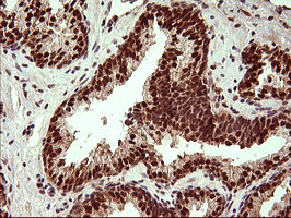 UPRT Antibody in Immunohistochemistry (Paraffin) (IHC (P))