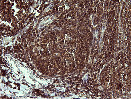 UPRT Antibody in Immunohistochemistry (Paraffin) (IHC (P))