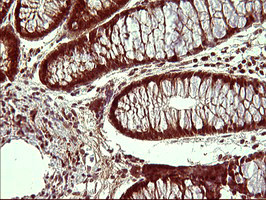 UPRT Antibody in Immunohistochemistry (Paraffin) (IHC (P))