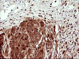 UPRT Antibody in Immunohistochemistry (Paraffin) (IHC (P))