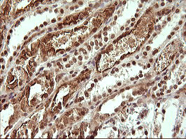 UPRT Antibody in Immunohistochemistry (Paraffin) (IHC (P))