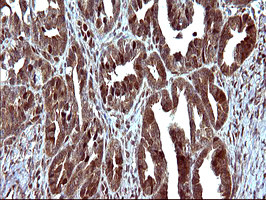 UPRT Antibody in Immunohistochemistry (Paraffin) (IHC (P))