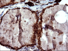 UPRT Antibody in Immunohistochemistry (Paraffin) (IHC (P))