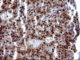 UPRT Antibody in Immunohistochemistry (Paraffin) (IHC (P))